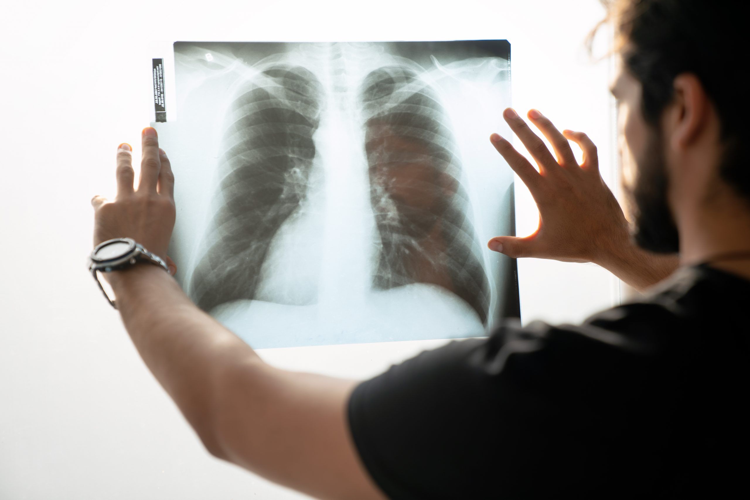 Detección de fibrosis quística